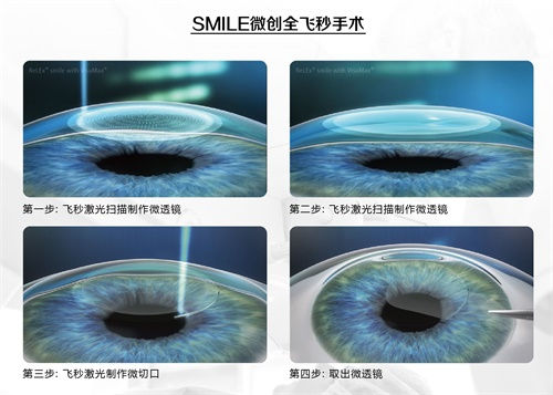 眼科謠言，你的“好心轉(zhuǎn)載”辦了多少壞事