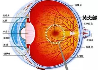 黃斑變性是怎么回事？黃斑變性的方法？