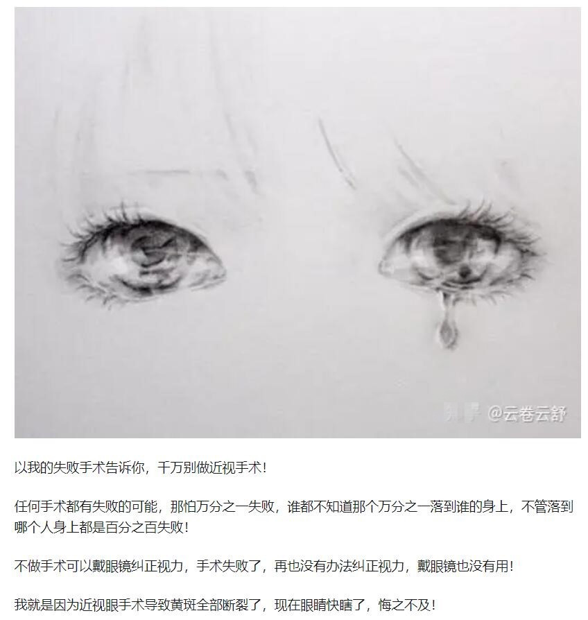 教你，怎樣去了解近視手術(shù)  